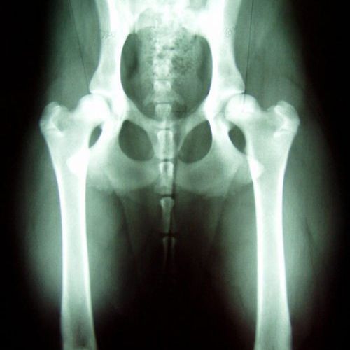 Radiografía de control de displastia de cadera