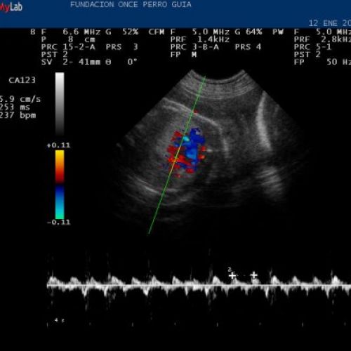 Control gestacional de sufrimiento fetal